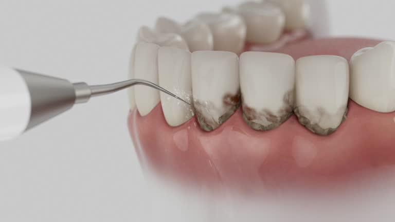 Trusted Dental Crowns And Bridges service in Camp Springs, MD - Dentist Open Now